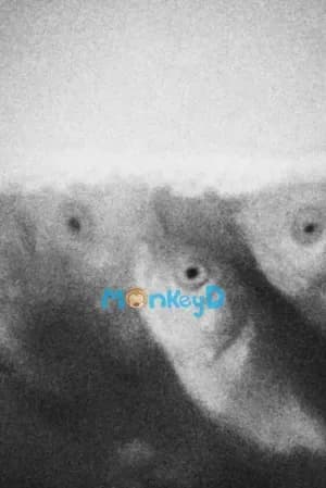 Bệnh Nan Y